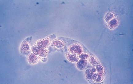 <p>Identify the urine sediment element shown and what perspective it is in</p>