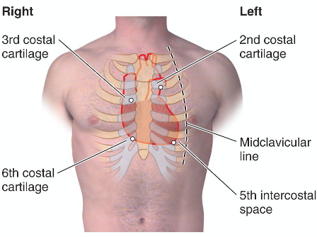 PMI is located left of the midclavicular line at the 5th intercostal space