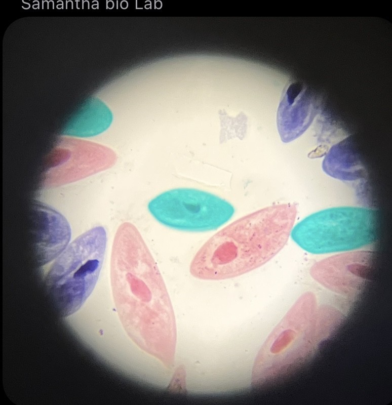 <p>What is the organism and is it prokaryotic or eukaryotic?</p>