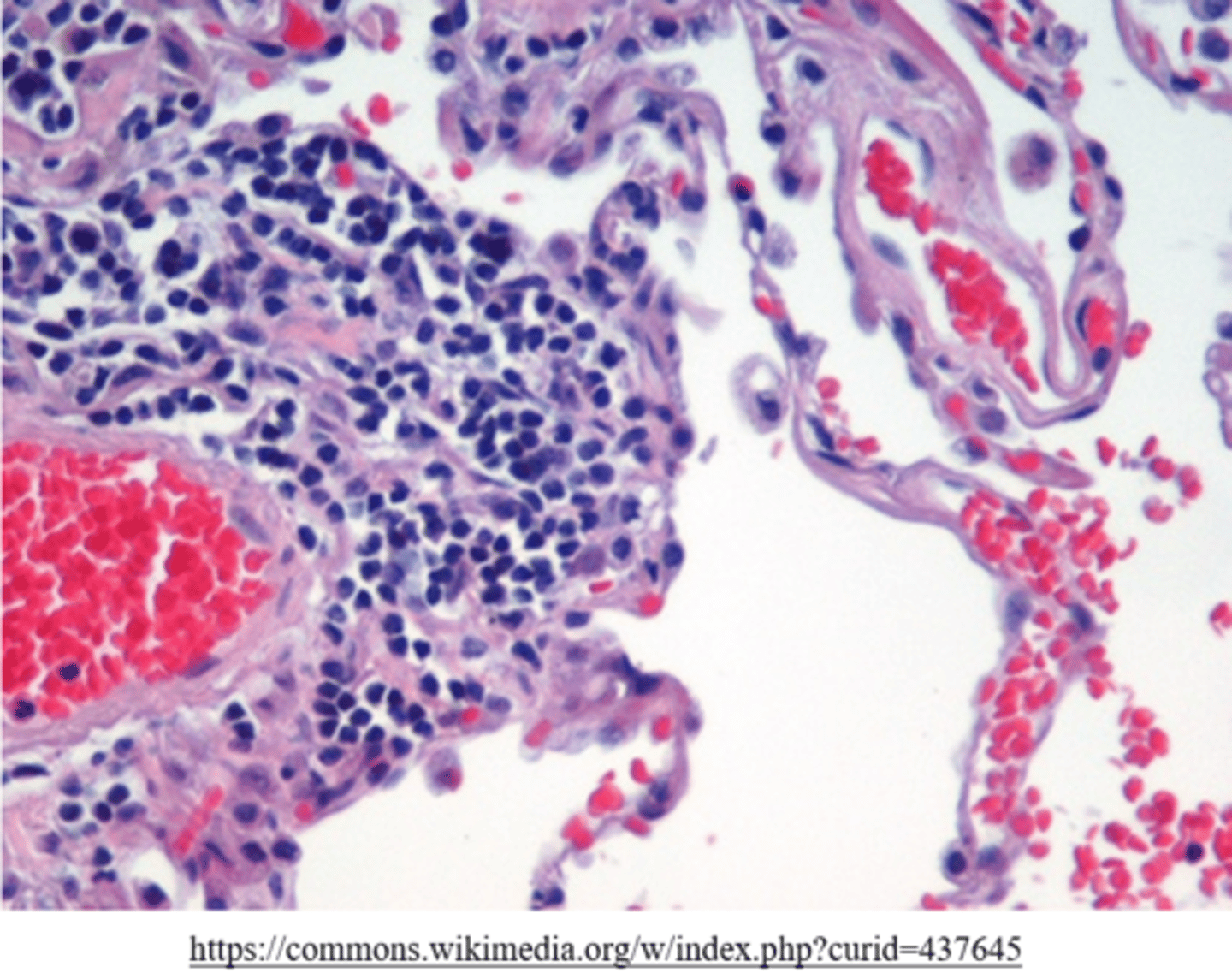 <p>staining</p>