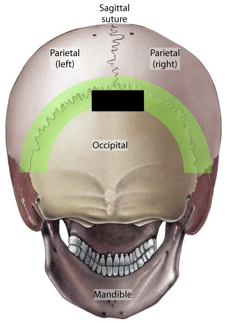 What suture is this?