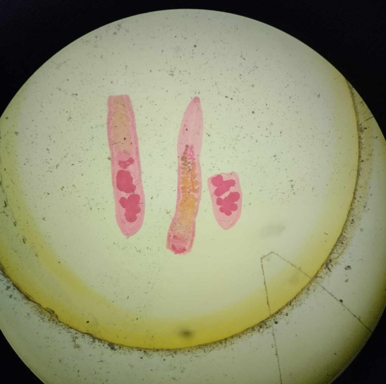 <p><em>Opisthorchis obsequens</em></p><p>DH: domestic ducks</p><p>Organ location: bile ducts and liver</p>
