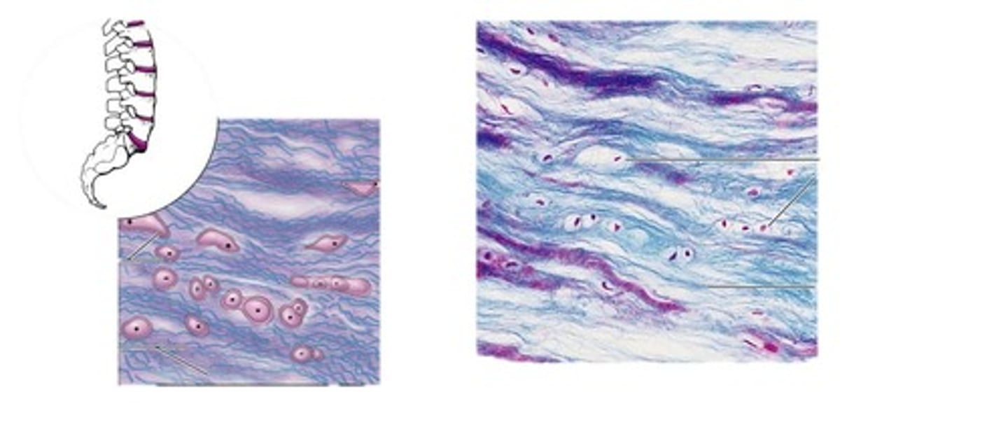 <p>thick collagen fibersgive great tensile strength; menisci of knee; vertebral discs</p>