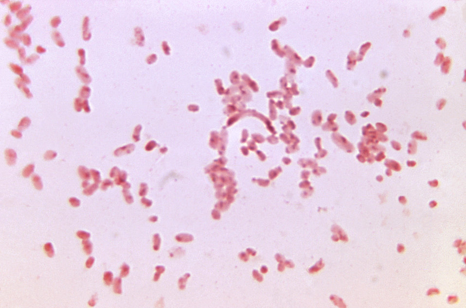 <p>Pleomorphic rods with globular swelling </p>
