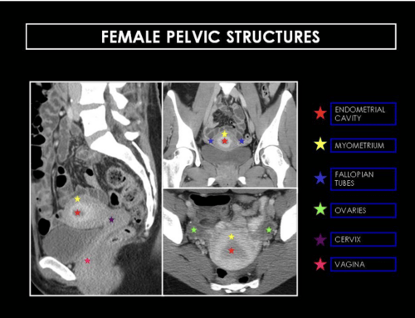 <p>Suspected malignancy spread, Acute abdomen, and Surgical planning</p>