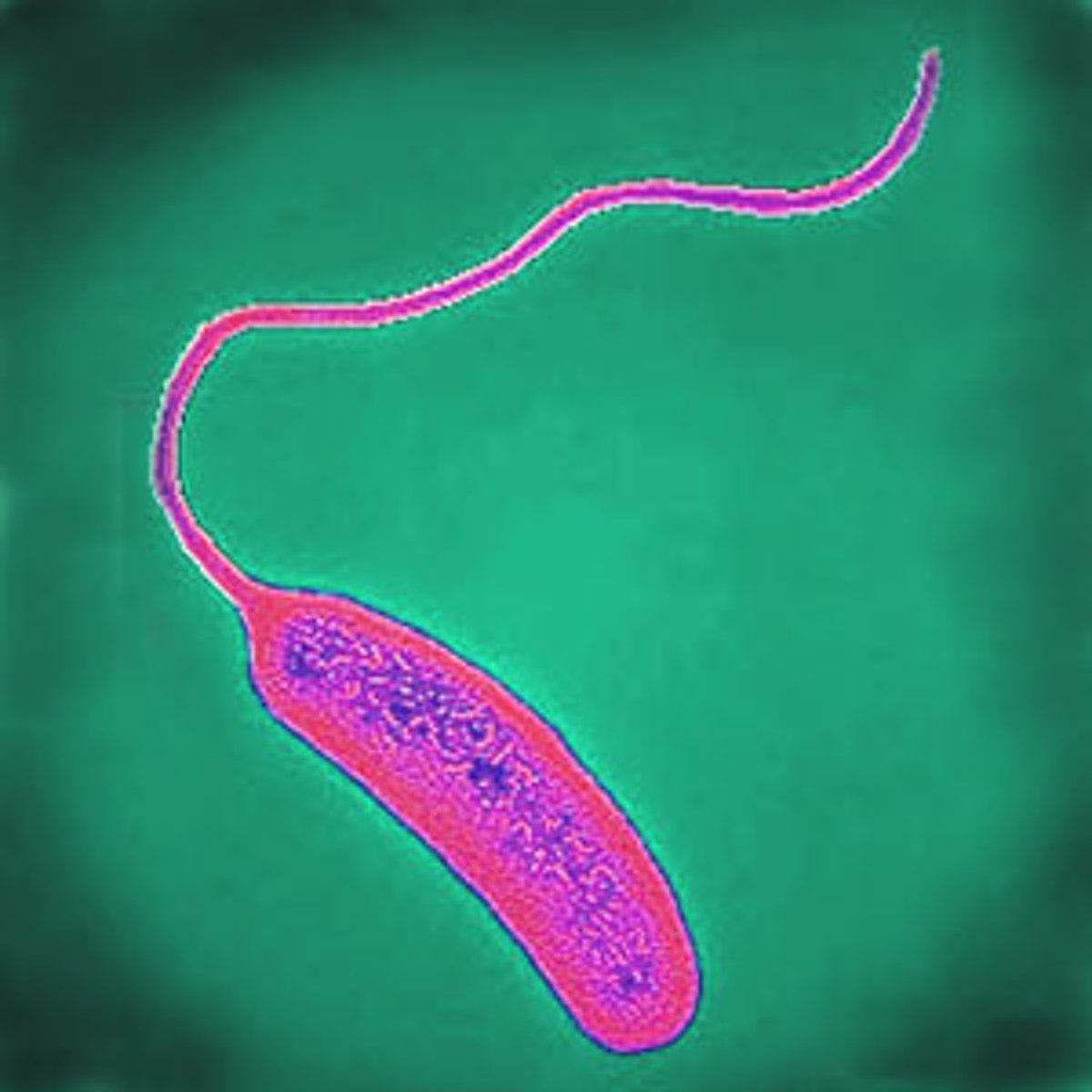 <p>Comma-shaped, highly motile (flagellum), Gram negative bacteria</p><p>Responsible for cholera infections via ingestion of contaminated water</p>