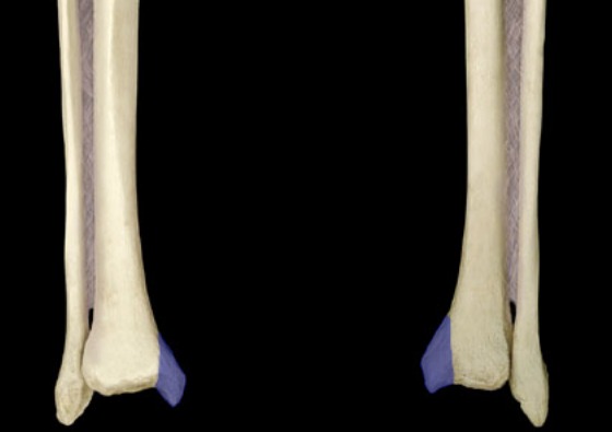 <p>distal projection sticking downward; big bump on ankle medial</p>