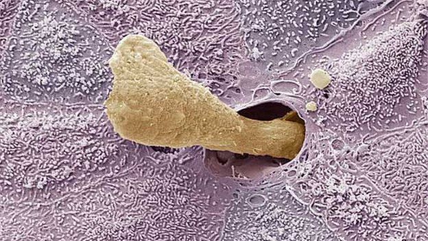 ear wax