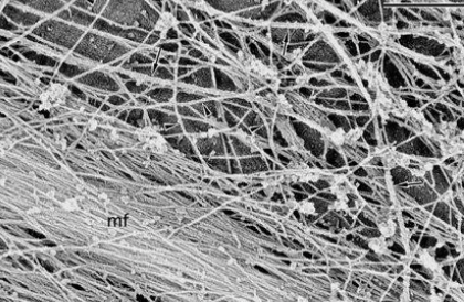 <p>network of protein fibres, including microfilaments (actin), microtubules (tubulin), intermediate filaments (fibrous proteins), support cells and organelles, motor proteins use ATP to move organelles/molecules</p>