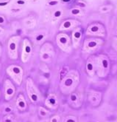 <ul>
<li><strong>Most Common Type</strong>: Prevalent throughout the body.</li>
<li><strong>Appearance</strong>: <strong>Glassy and translucent</strong> in fresh tissue.</li>
<li><strong>Fiber Composition</strong>: Fine, invisible network of mostly <strong>Type II collagen</strong> fibers.</li>
<li><strong>Locations</strong>: Articular surfaces, respiratory tract, costal cartilages, embryonic skeleton.</li>
<li><strong>Perichondrium</strong>: Present, <em>except</em> at articular surfaces (for easier movement).</li>
</ul>
<!-- -->