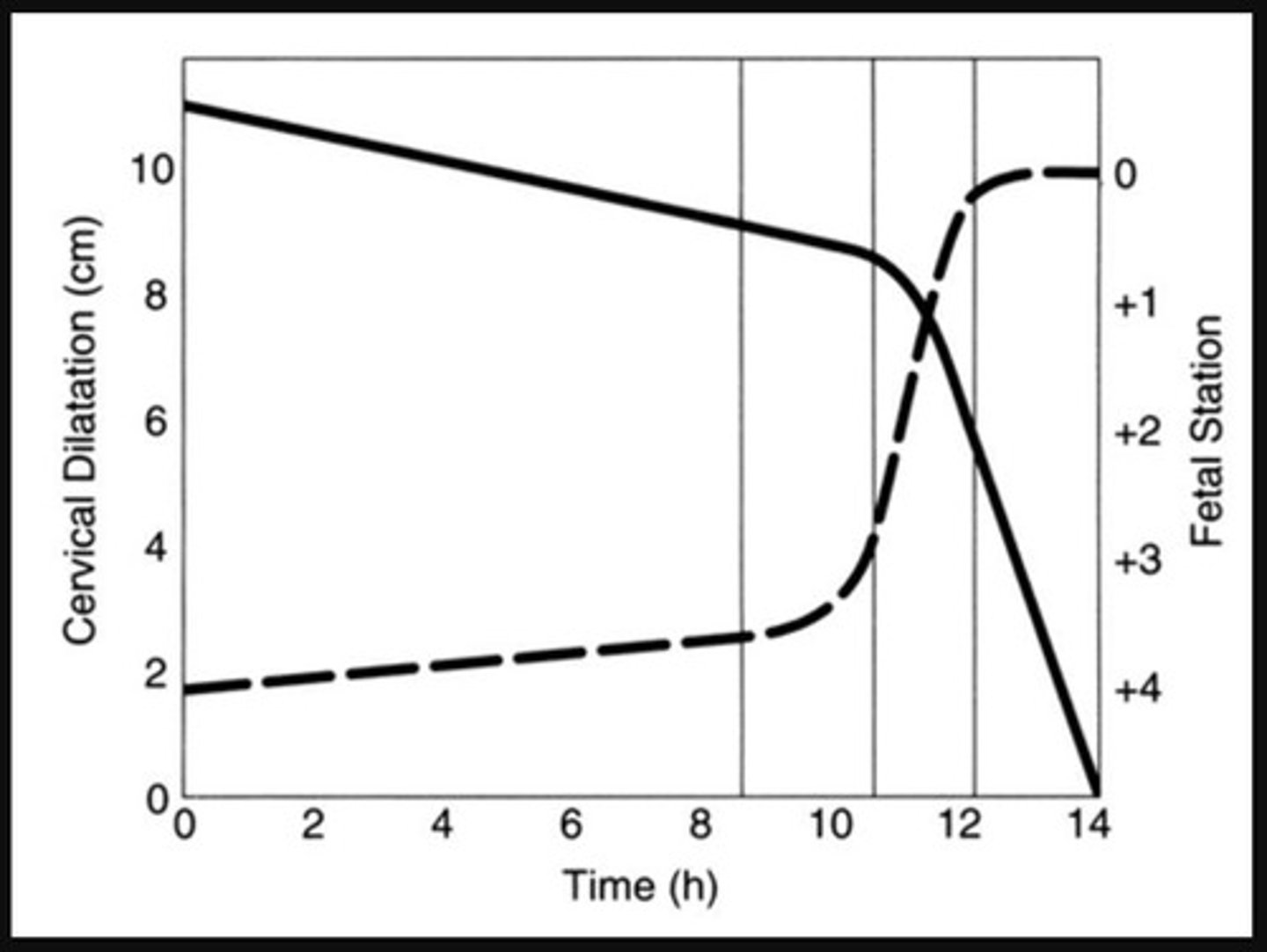 <p>To show the relationship between cervical dilation and descent in labor.</p>