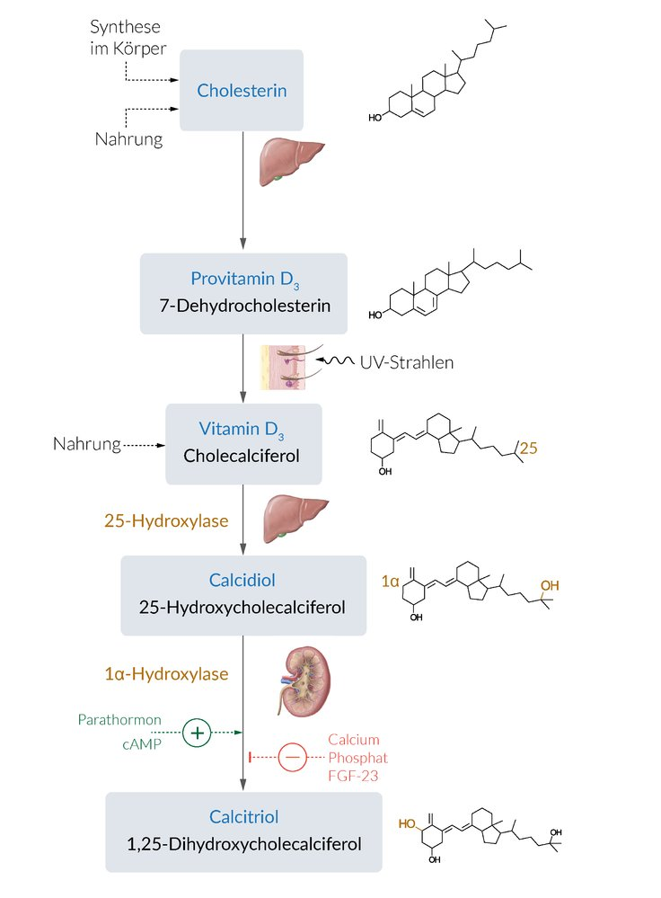 <p>A. Dialysis-dependent renal failure</p>