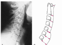 <p>Q what is the name of this measurement? and what is the average + range?</p>