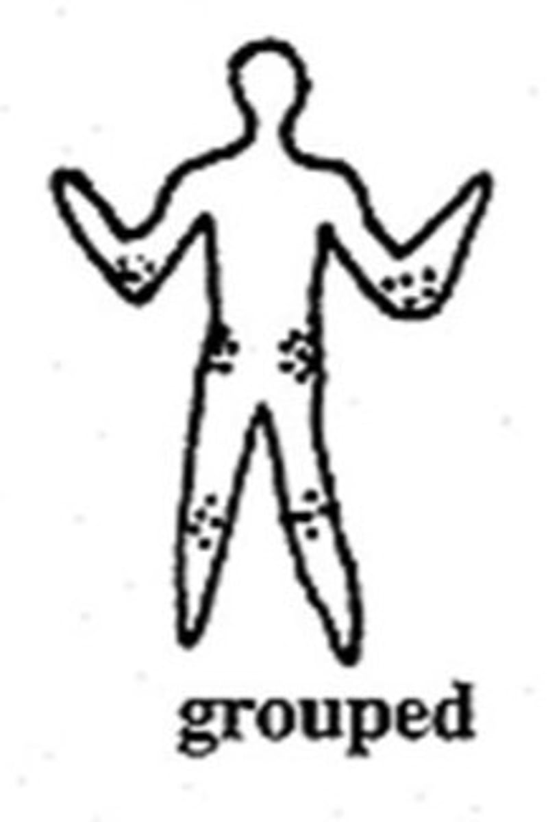<p>lesions appear in clusters or groups</p>
