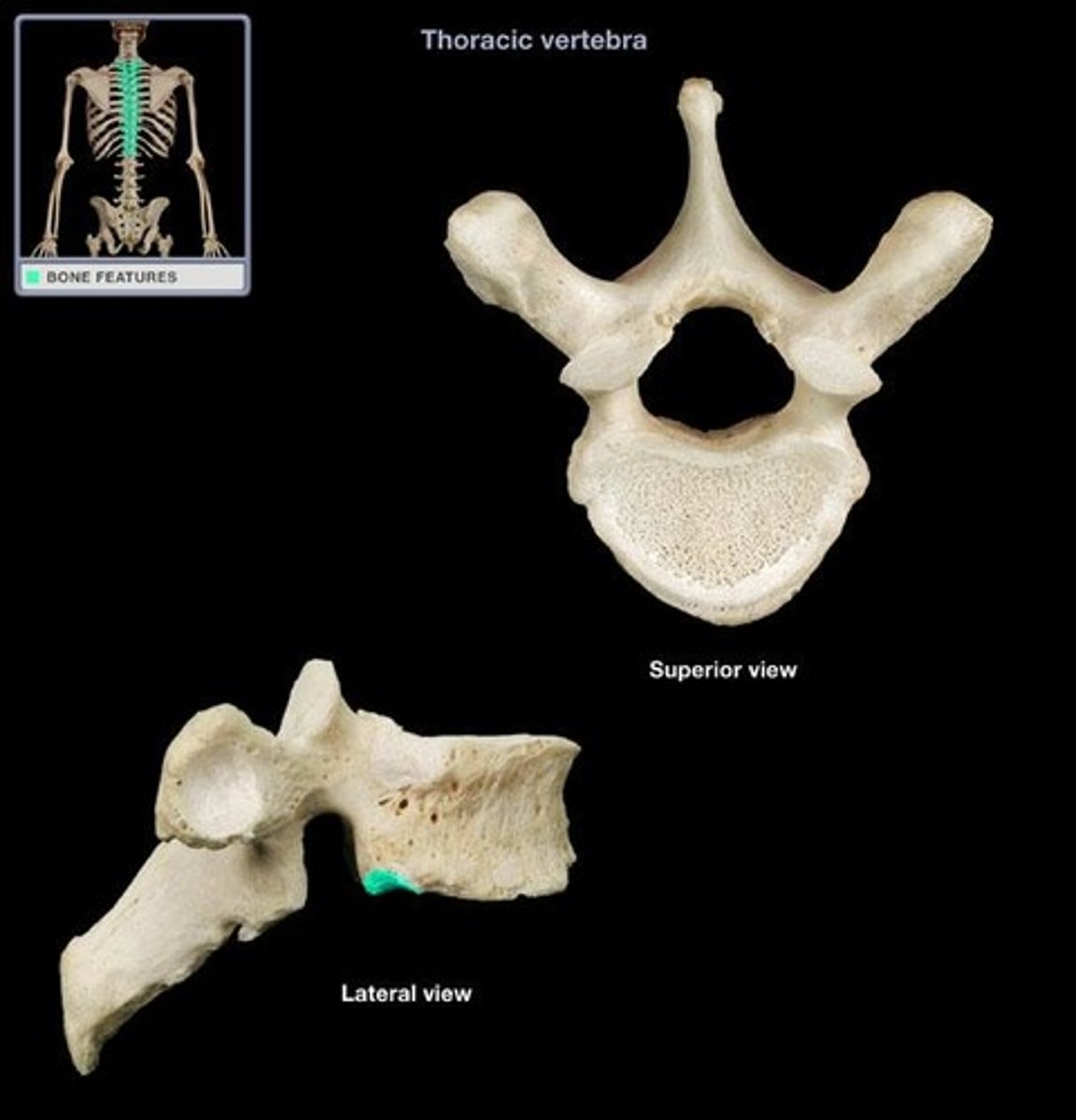 <p>receive the head of the ribs on the inferior side; only in thoracic vertebrae</p>