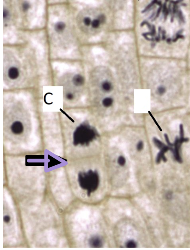 <p>what stage of cell division is this? </p>
