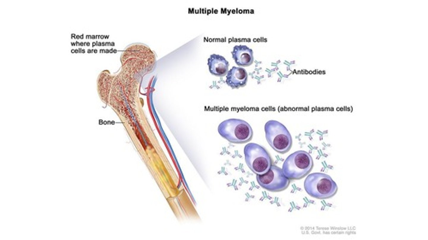<p>Bone marrow cancer that affects blood cells.</p>