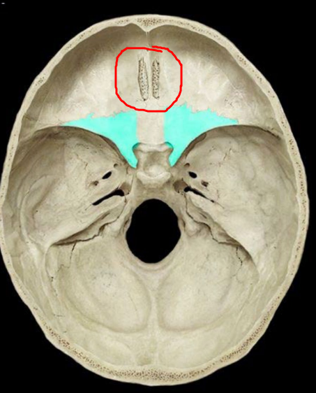 <p>Cribriform plate</p>