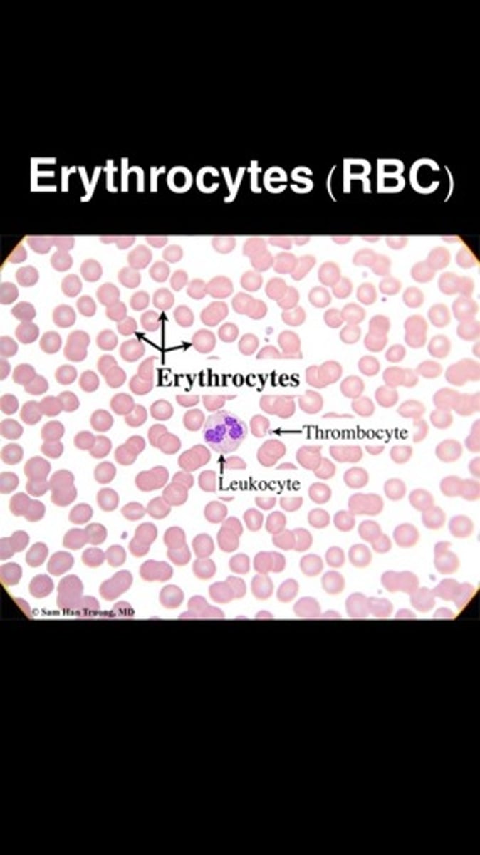 <p>biconcave shape</p><p>- size: 7-8uM</p><p>- MCV: 80-100fL</p>