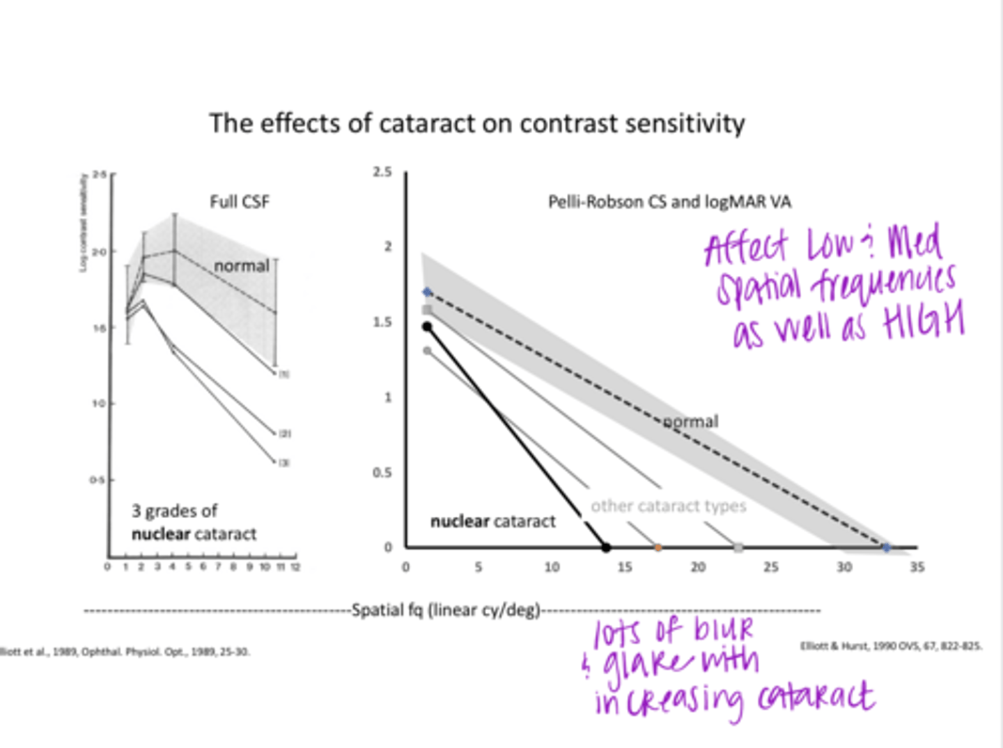<p>Increasing cataract severity will shift the log contrast sensitivity v linear spatial frequency graph lines where?</p>
