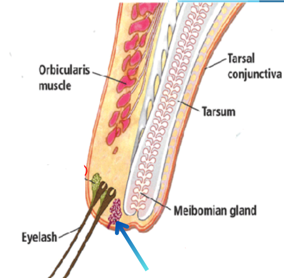 term image