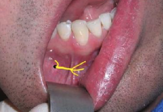 <p>which nerve is displayed here?</p>