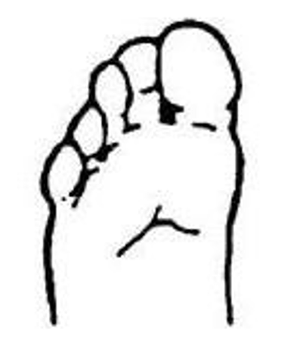 <p>toe flexion</p>
