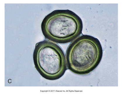 <p>Thicker outer shell, hexacanth in egg</p>