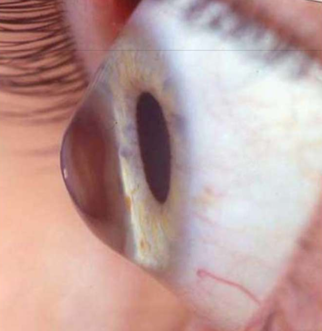 <p>Name the finding</p>