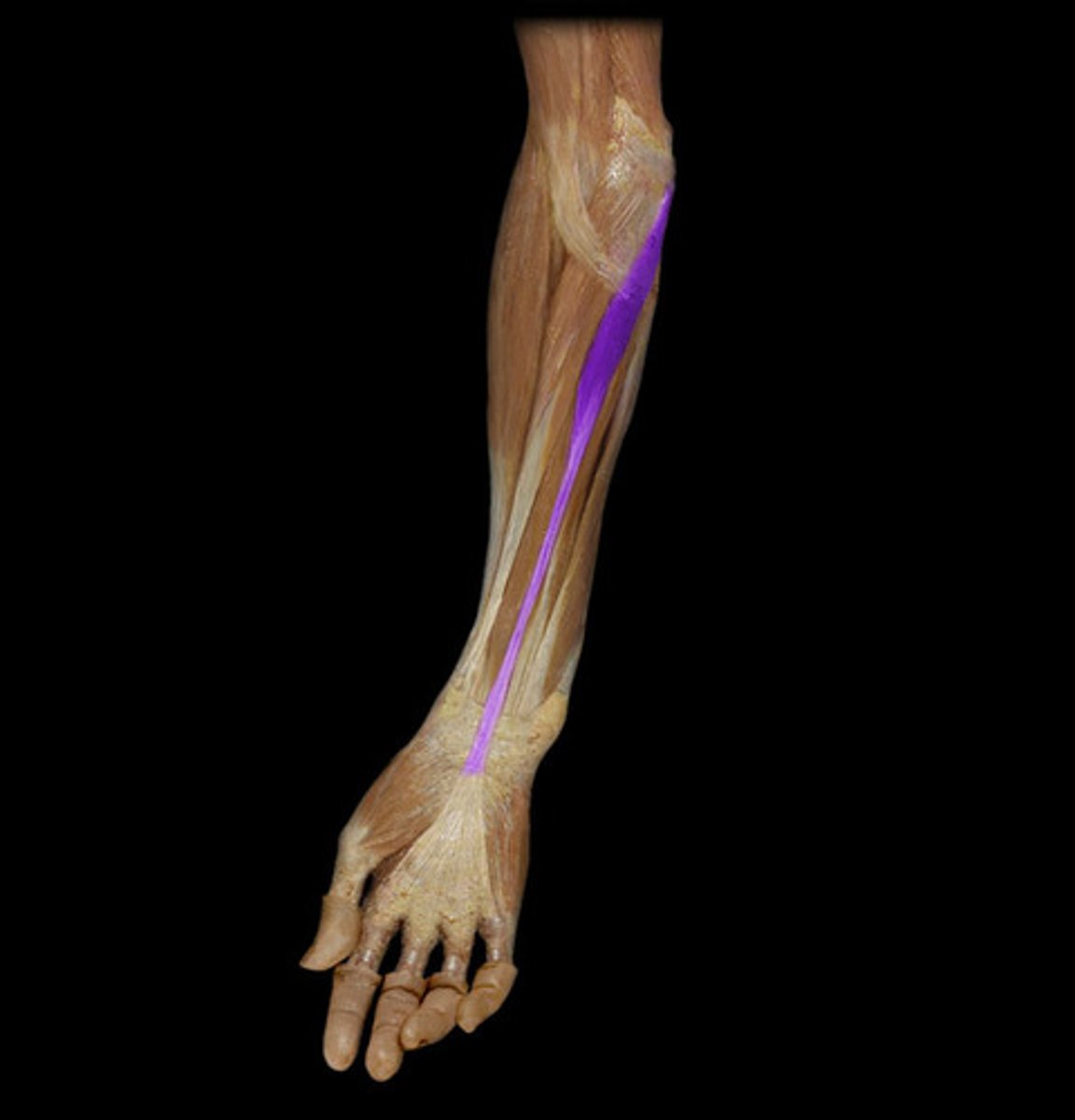 <p>Name the muscle highlighted in purple</p>