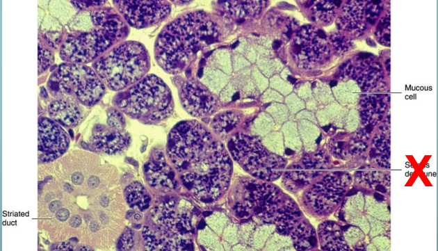 <p>which gland is this </p>
