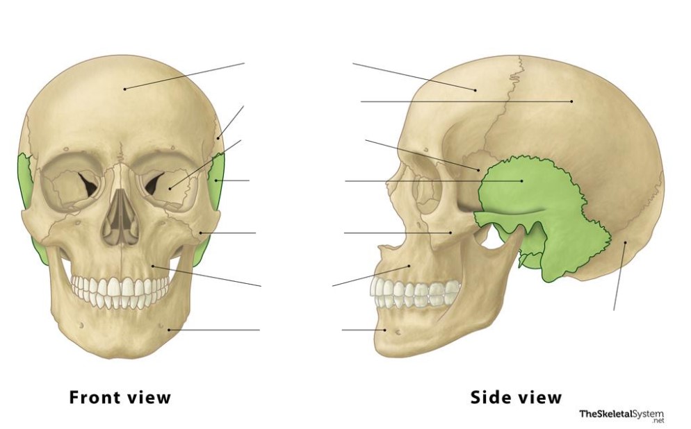 <p>These bones are the ________ bones.</p>