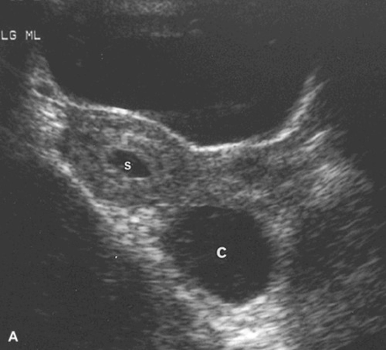 <p>Produces progesterone + estrogen</p>