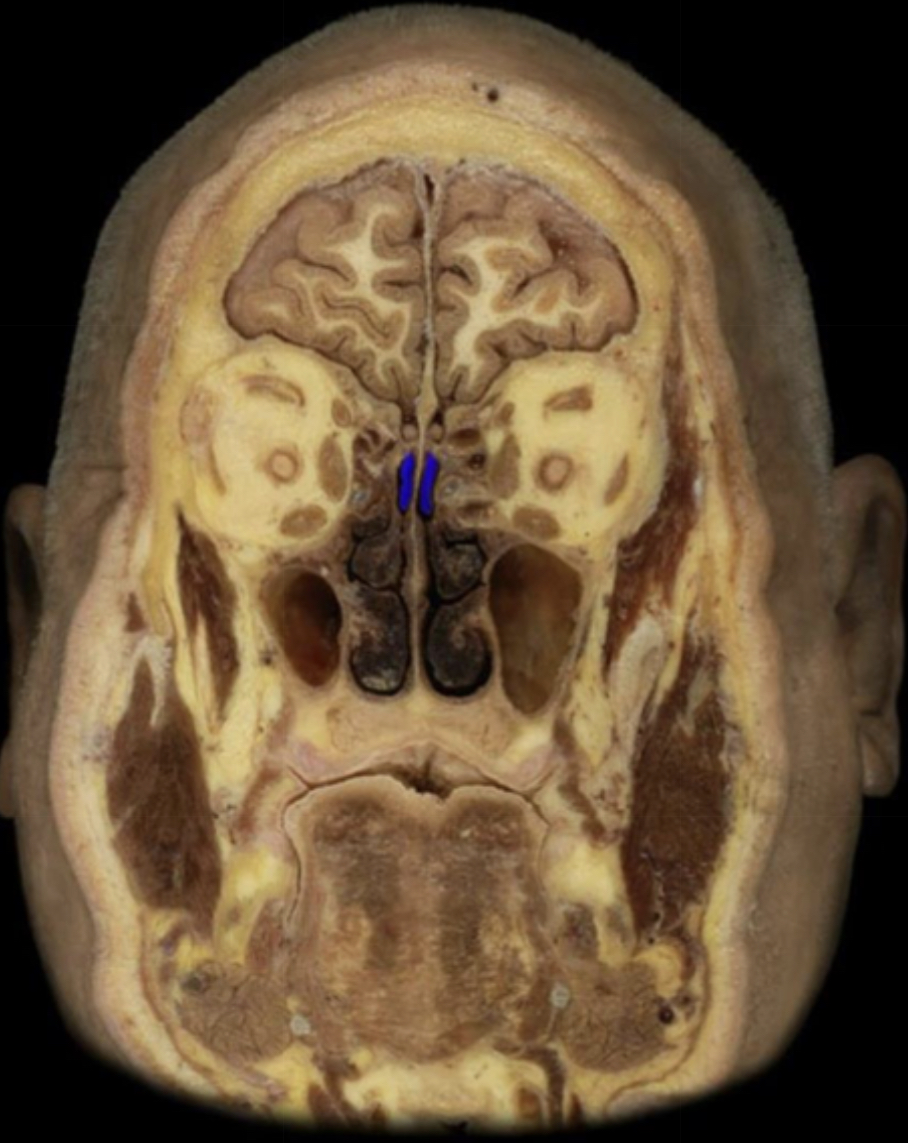 What structure is highlighted in blue?