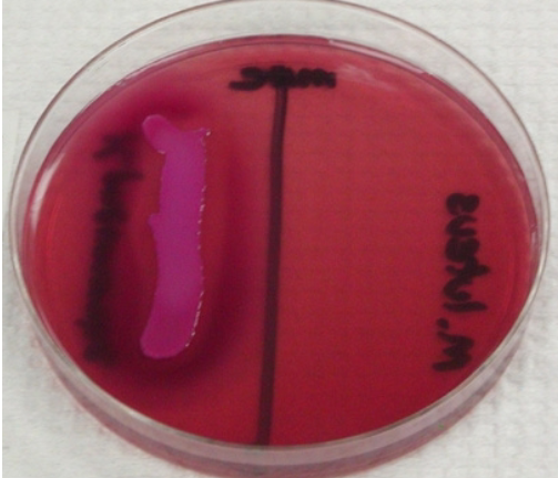 <p><span>Selects for Gram - species</span></p><p>Differentiates lactose fermenters with lactose fermenters turning the plate pink, non fermenters orange/unchanged</p>