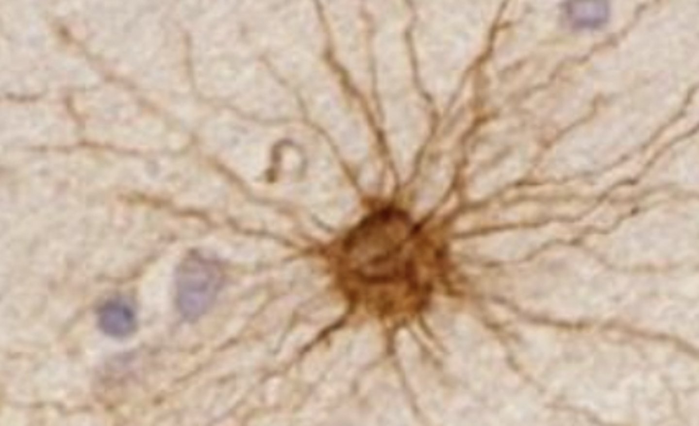 <p>what is this cell in the CNS?</p>