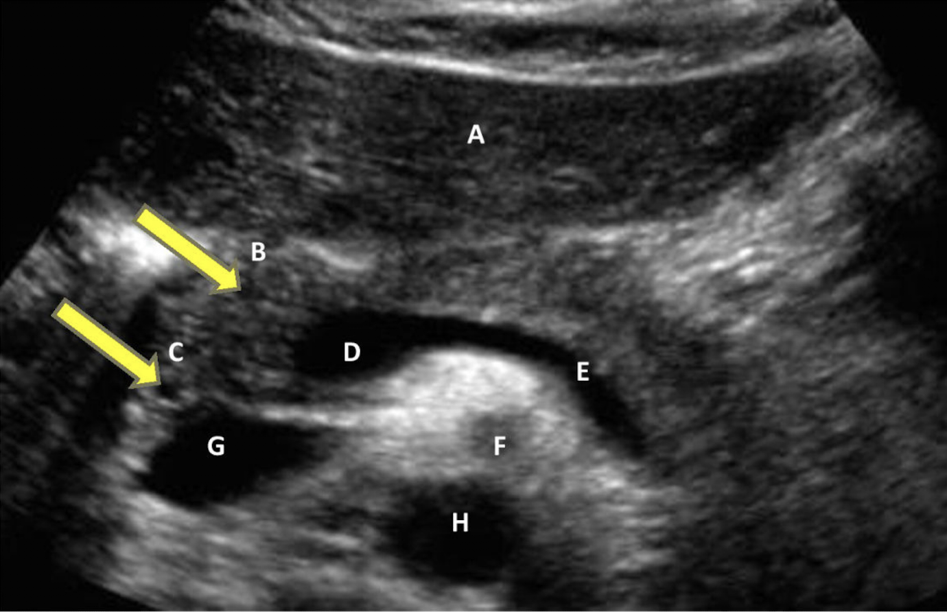<p>identify all structures</p>