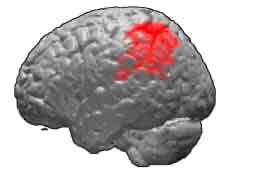 <p>Paulesu et al: aim</p>
