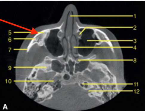 <p>identify the structure </p>