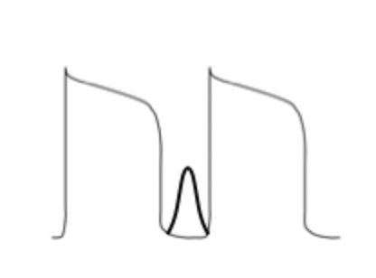 <p>what is the current in black? </p>