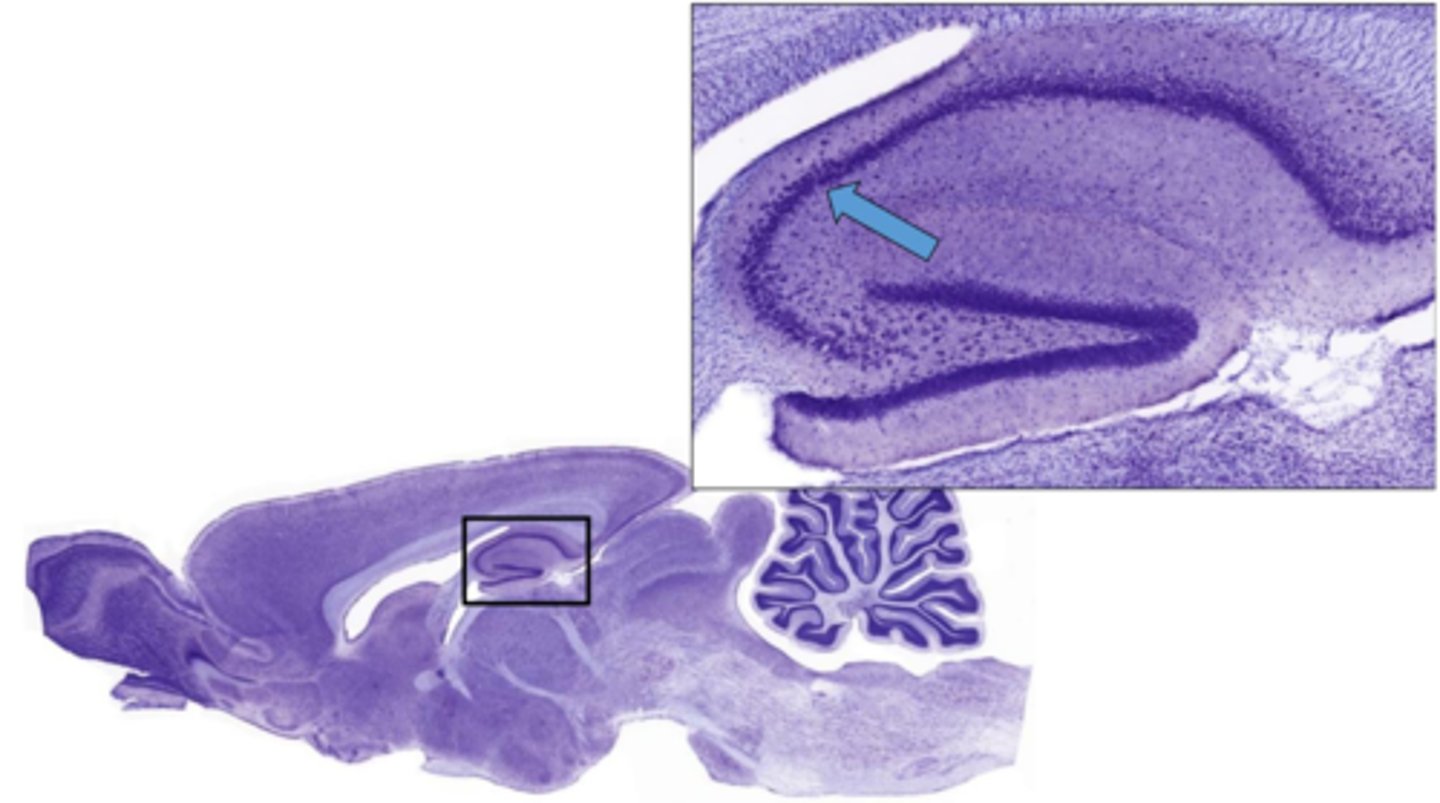 <p>Identify the specific part of the brain in the inset</p>