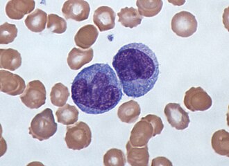 <p>which leukocyte is this?</p>