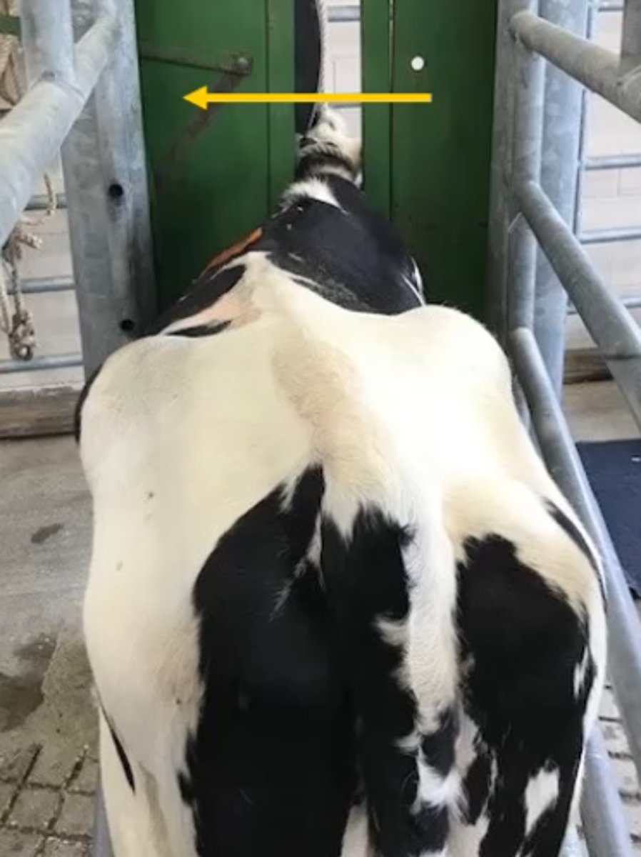 <p>Scoliosis (bend toward injection cuz relaxed muscles)</p>