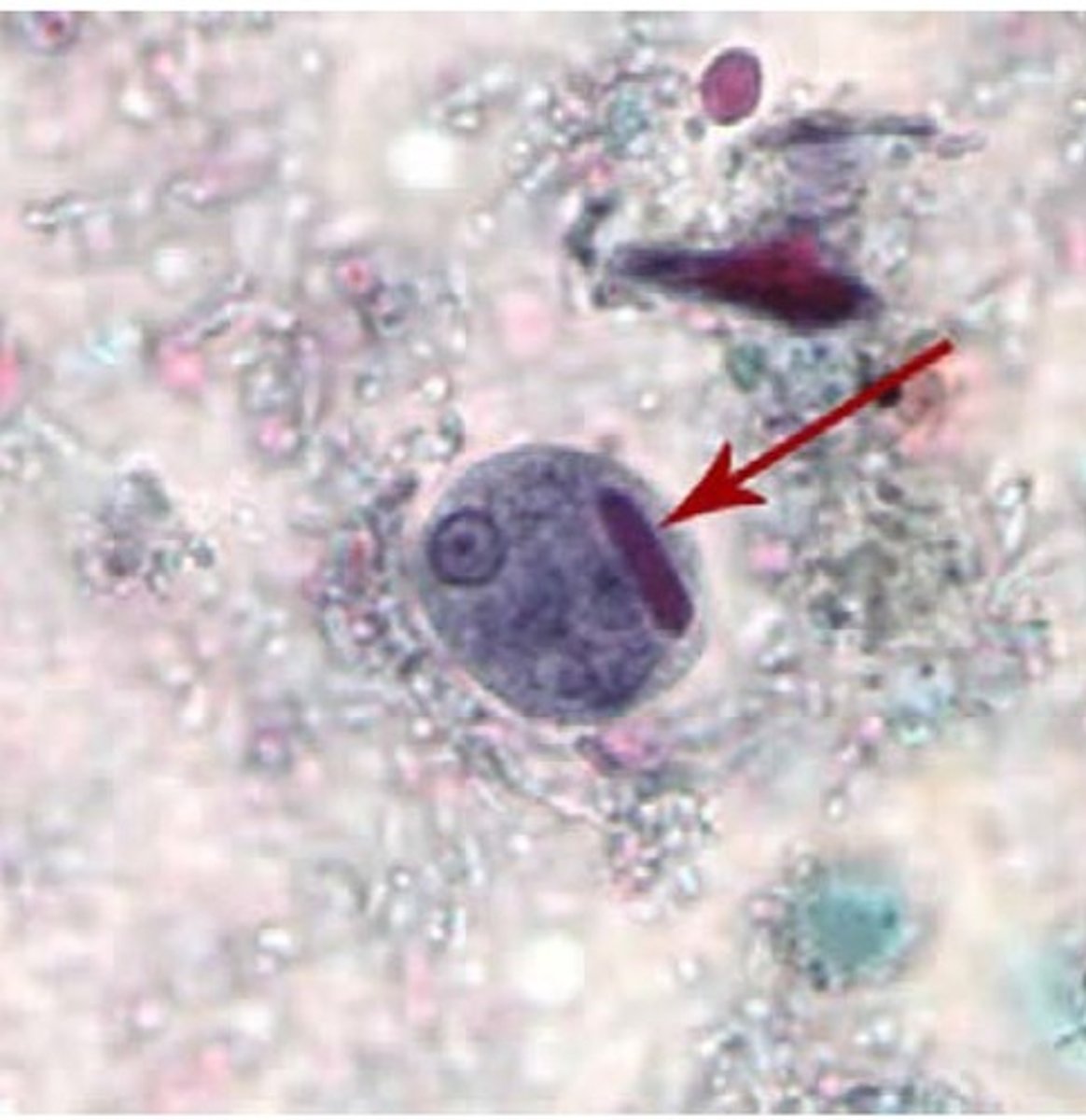 <p>c. Entamoeba histolytica</p>