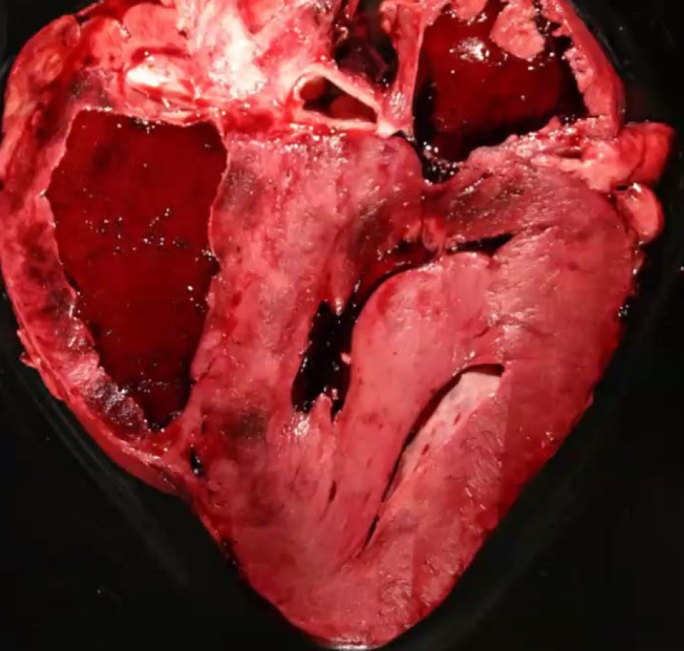 <p>What is other organ affected?</p><p>A-Brain</p><p>B-Skeletal muscle</p><p>C-Lung </p><p>D-Mammary gland</p>