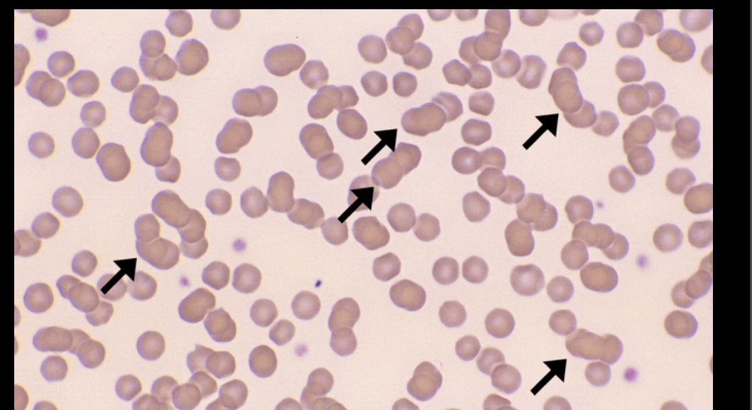 <p>What RBC is this? </p>