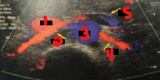 <p>Label the crossed-out structures seen on this image.&nbsp;</p>