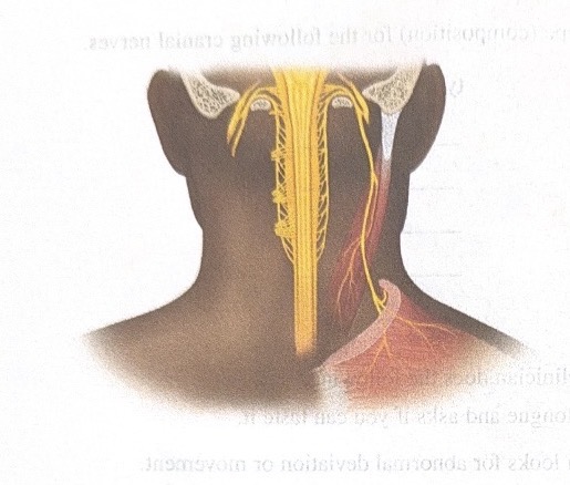 <p>Name this cranial nerve</p>