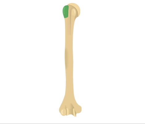 <p>What part of the humerus is this?</p>