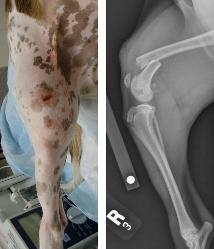 <p><span>The wound is less than 1cm, caused from the inside (bone poking out).&nbsp;</span><br><br><span>Typically seen with low energy traumatic impacts - simple fracture patterns and minimal soft tissue damage.&nbsp;</span><br><br><span>Of the open fractures, Type I fractures have the least amount of wound contamination, with low infection and complication rates.</span></p>